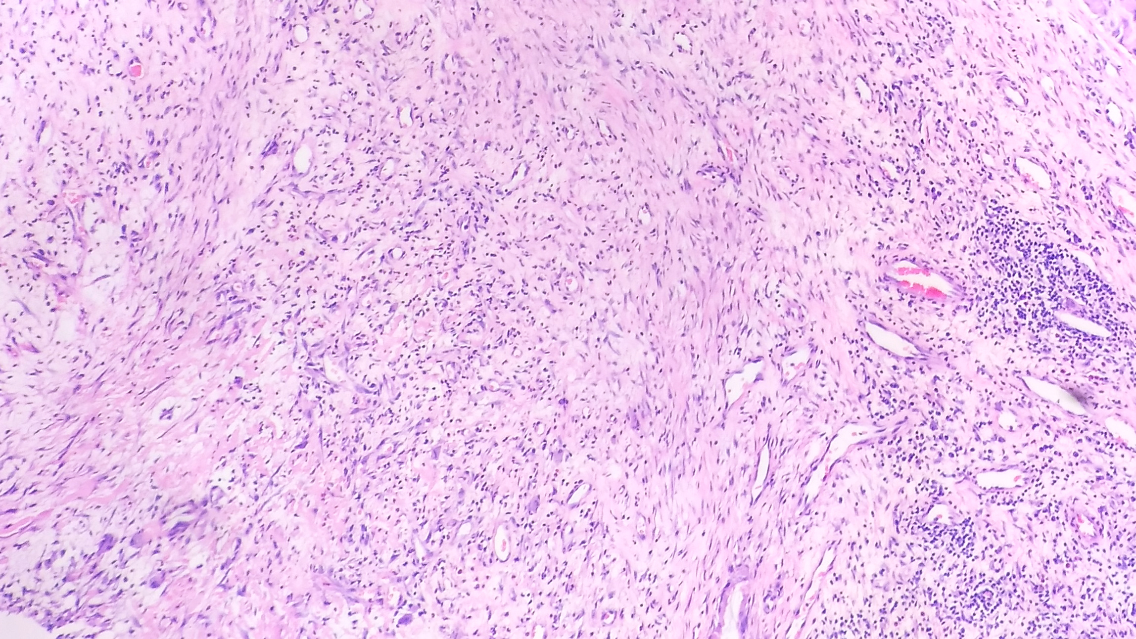 肉芽组织形态 (3).jpg